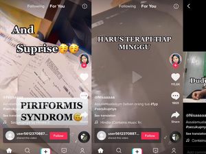 Viral Mahasiswi Kena Piriformis Syndrome akibat Kelamaan Duduk Kuliah Online
