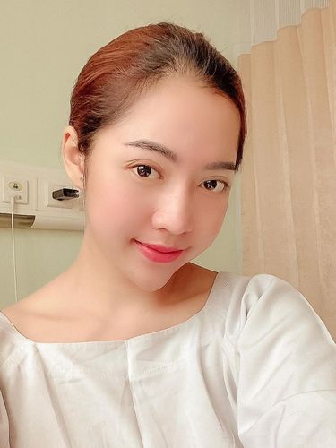 Selebgram Monica Indah yang menjalani filler abal-abal.