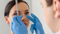 Mengenal Rhinoplasty Tulang Iga: Operasi Plastik Hidung Agar Proporsional