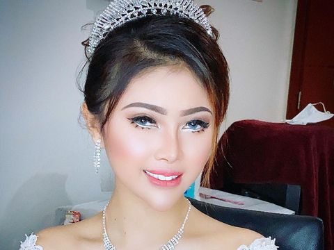 Selebgram Meicha Lee yang menjalani filler abal-abal.