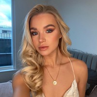 Abbie Quinnen dikenal punya wajah yang flawless. Tapi kini penampilannya mungkin tak akan sama lagi setelah wajahnya terkena bola api.  Foto: dok. Instagram