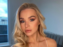 8 Foto Wajah Flawless Selebgram Sebelum Terkena Bola Api Saat Bikin Konten