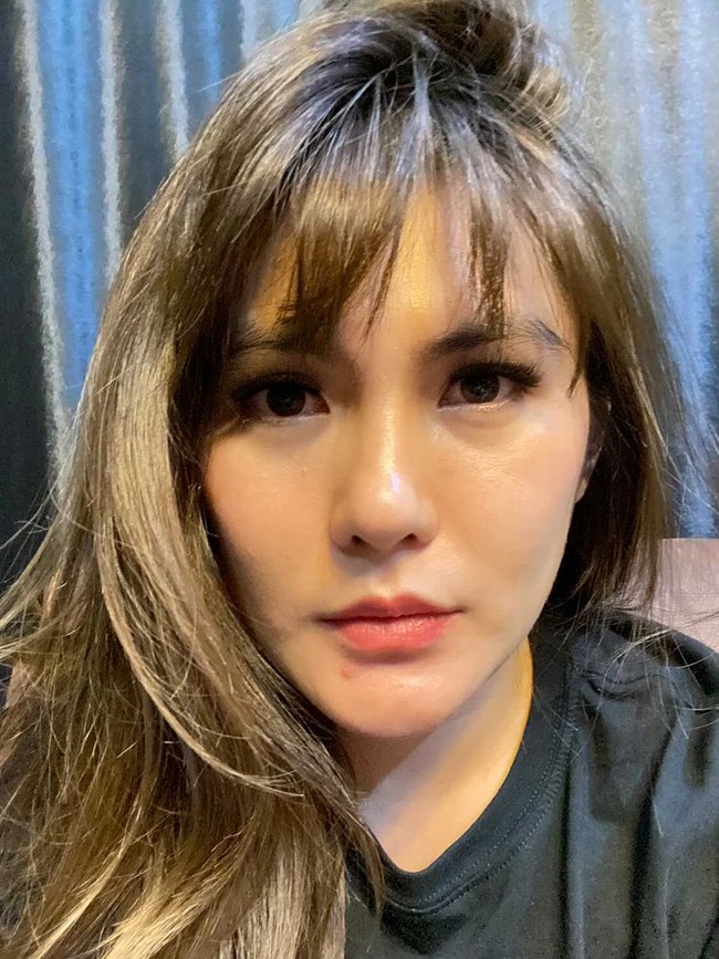 Angela Lee baru-baru ini secara terang-terangan memperlihatkan keadaan wajahnya usai menjalani operasi plastik pada hidungnya. Sebenarnya Angela Lee sendiri sudah memiliki hidung yang cukup mancung sebelum melakukan operasi plastik tersebut. Melalui sebuah balasan di kolom komentar salah satu unggahannya Angela mengatakan bahwa dia tertarik untuk melakukan operasi hidung karena menurutnya hidungnya miring. Foto: dok. Pribadi Angela Lee