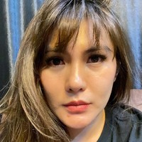 Angela Lee baru-baru ini secara terang-terangan memperlihatkan keadaan wajahnya usai menjalani operasi plastik pada hidungnya. Sebenarnya Angela Lee sendiri sudah memiliki hidung yang cukup mancung sebelum melakukan operasi plastik tersebut. Melalui sebuah balasan di kolom komentar salah satu unggahannya Angela mengatakan bahwa dia tertarik untuk melakukan operasi hidung karena menurutnya hidungnya miring. Foto: dok. Pribadi Angela Lee