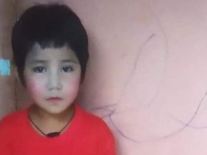Kata Terakhir Bocah Myanmar Tewas Ditembak: Aku Tidak Tahan Ayah, Sakit Sekali