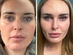 10 Transformasi Wajah Orang-orang yang Berubah Drastis Setelah Oplas