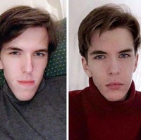 Sebelum dan setelah: 4 bulan jarak antara (pengambilan) kedua foto, tulis akun Reddit bernama @acari_. Foto: acari_ / reddit