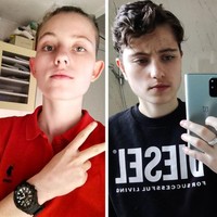 Wajah pria ini berubah drastis, 3 tahun setelah operasi plastik. Foto: Randomguy*** / reddit