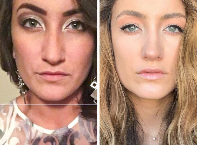 Ini transformasi seorang wanita pengguna akun Reddit sebelum dan setelah operasi plastik selama lebih dari satu tahun. Terlihat perbedaannya? Foto: habtobe / reddit
