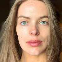 Model asal Australia Robyn Lawley mengalami musibah yang tidak diduga-duga pada 2018. Robyn jatuh dari tangga dan wajahnya mendarat di lantai. 2 Foto: Dok. Instagram/@robynlawley