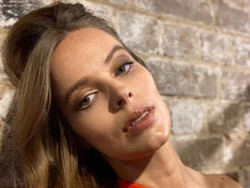 Tulang Tengkorak Pernah Retak, Ini Foto Model yang Punya Bekas Luka di Dahi