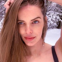 Sebagai model, wajah flawless-nya selama ini menjadi asetnya. Tentu saja butuh waktu untuk bisa menerima lukanya itu.  Foto: Dok. Instagram/@robynlawley