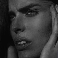 Meski kadang saat pemotretan, bekas lukanya mampu tertutupi denga makeup atau editan foto, namun Robyn pun tidak malu melakukan foto dengan memamerkan luka di dahinya.  Foto: Dok. Instagram/@robynlawley