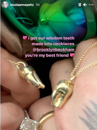 Kalung terbuat dari gigi Brooklyn Beckham dan Nicola Peltz.