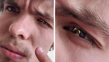 Seekor tawon tertangkap tepat di depan mata, membuat orang tersebut tampak seperti memiliki mata emas. Foto: Brightside/_epicTrash_ / Reddit