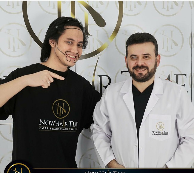 Kevin melakukan transplantasi rambut di klinik kecantikan Now Hair Time di Istanbul, Turki. Tak hanya rambut, suami dari Vicie Melanie itu juga melakukan cangkok di area dagu untuk menumbuhkan jenggotnya.  Foto: Dok. Instagram/@now.hairtime