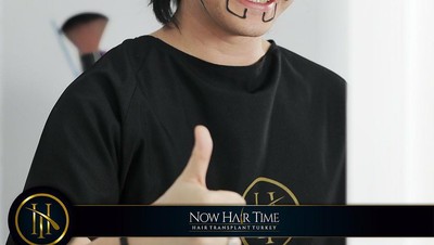 7 Foto Kevin Aprilio Cangkok Rambut di Turki, Sempat Tampil Botak