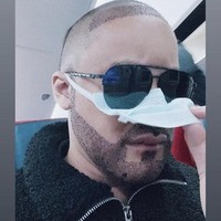 Setelah transplantasi, Kevin pun memperlihatkan rambutnya yang digunduli. Setelah itu baru proses transplantasi yang prosesnya menggunakan pisau bedah. Operasi ringan tersebut berfungsi untuk mencangkok unit-unit folikel.  Foto: Dok. Instagram/@kevinaprilio