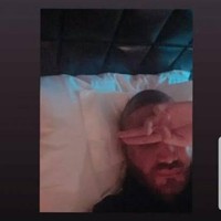 Selama ini Kevin selalu tampil dengan rambut gondrong dan terlihat lebat, tapi ternyata ada alasan khusus yang membuat Kevin melakukan transplantasi rambut. Dalam Instagram Story-nya, Kevin Aprilio menjelaskan bahwa selama ini dia merasa insecure dengan dahinya. Foto: Dok. Instagram/@kevinaprilio