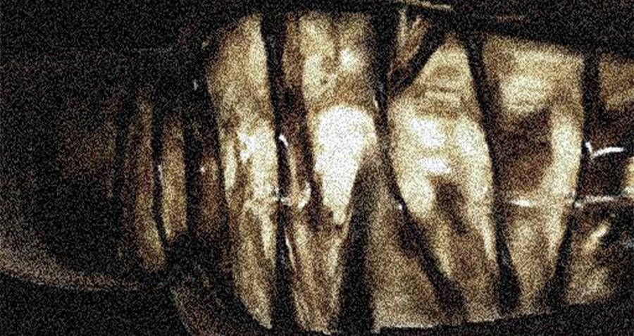 Hii! Permen Madu untuk Pengobatan Ini Terbuat dari Cairan Mayat