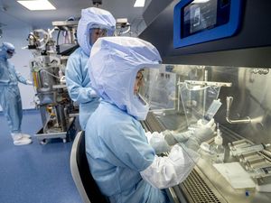 Virus Marburg Muncul Lagi Picu 6 Orang Tewas, Seserius Ini Gejalanya