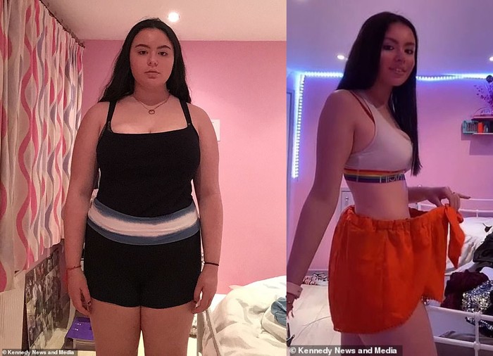 Keren! Diejek Mirip Kuda Nil, Remaja Ini Sukses Diet Turun BB 31 Kg Keren! Diejek Mirip Kuda Nil, Remaja Ini Sukses Diet Turun BB 31 Kg