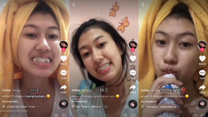 Viral Tiktok Viral cerita remaja gigi dikunci, hanya makan susu dan obat mag selama 2 minggu.