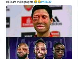 Arsenal Dihajar Liverpool, Rambut Aubameyang Jadi Ejekan