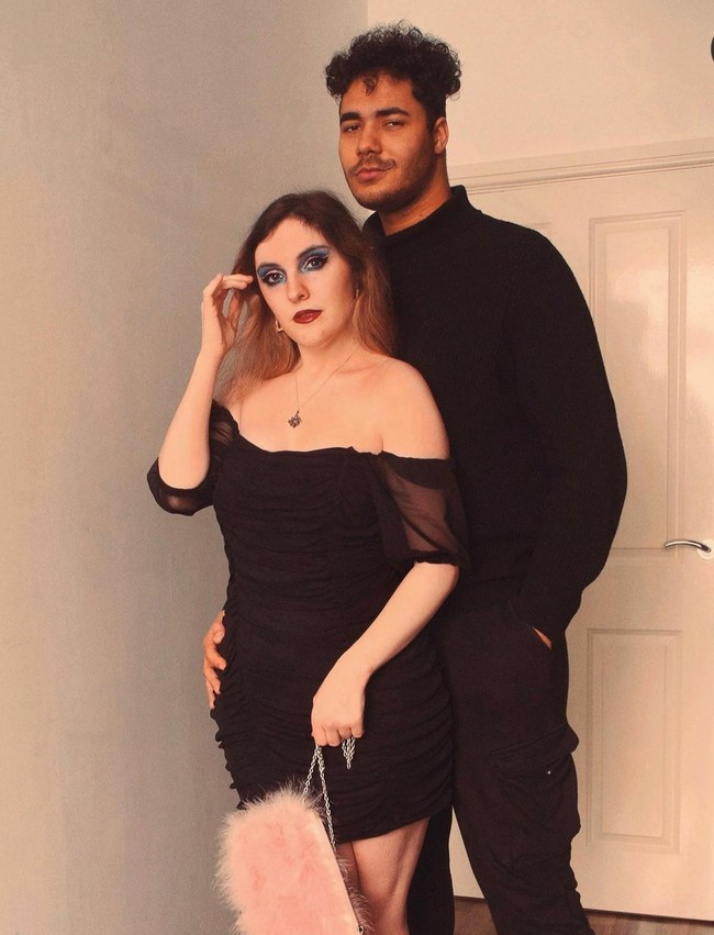 Becca kini menjadi bintang Instagram yang kerap memberikan pesan-pesan positif soal tubuh. Dia pun ingin wanita lain yang memiliki sindrom yang sama dengan dirinya bisa memiliki kepercayaan diri. Foto: Dok. Instagram/@beccabutcherx