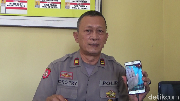 guru sulut siswanya dengan korek api