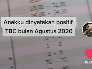 Bayinya Kena TBC, Ibu Ini Berpesan Jangan Sembarangan Cium Anak Orang