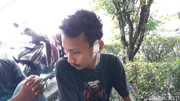 Korban penganiayaan oknum yang mengaku Brimob di Gunungkidul
