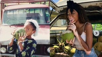 Fotomodel Winnie Harlow. Foto: Brightside