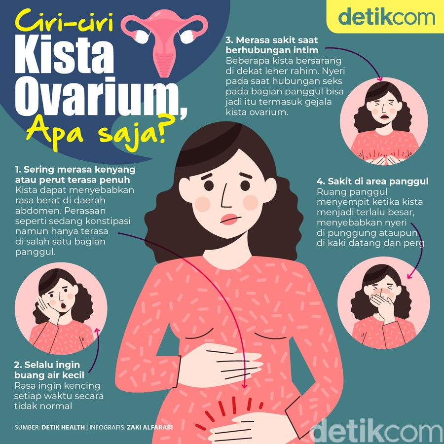 Ciri-ciri Kista Ovarium Seperti yang Sempat Diidap Aurel Hermansyah Ciri-ciri Kista Ovarium Seperti yang Sempat Diidap Aurel Hermansyah