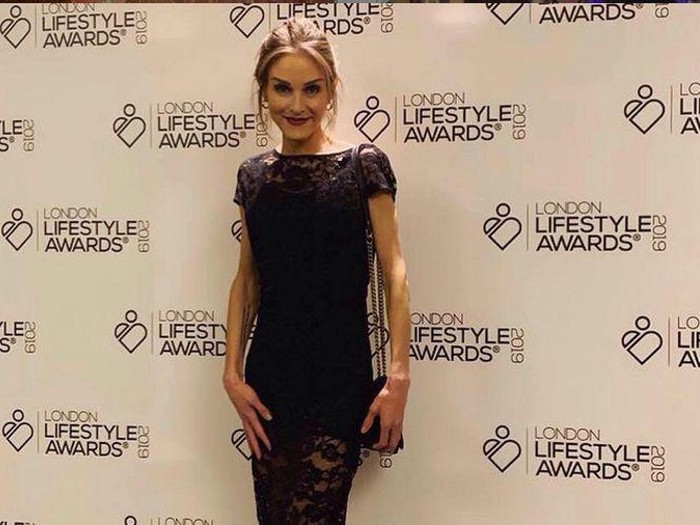 Nikki Grahame Nikki Grahame