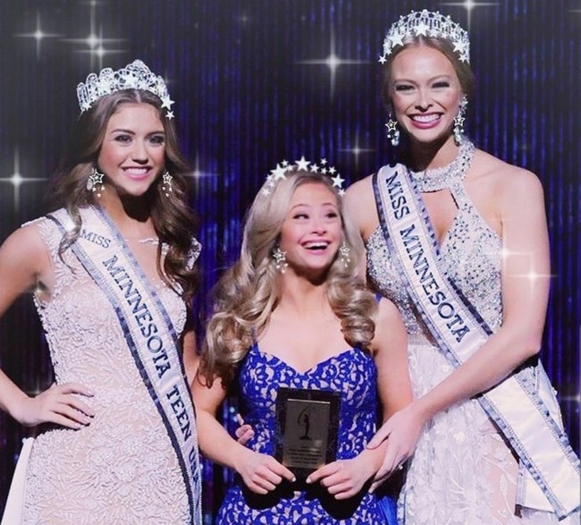 Mikayla pun menjadi wanita down syndrom pertama yang berkompetisi di kontes Miss USA 2017. Mikayla tidak ingin berhenti terus mengejar mimpinya di dunia modelling dan entertainment. Foto: Instagram