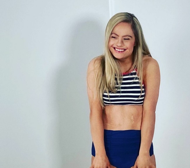Baru-baru ini, model down syndrome itu mendaftarkan diri untuk mengikuti ajang Sport Illustrated Swim agar bisa tampil di majalah pria dewasa tersebut. Foto: Instagram