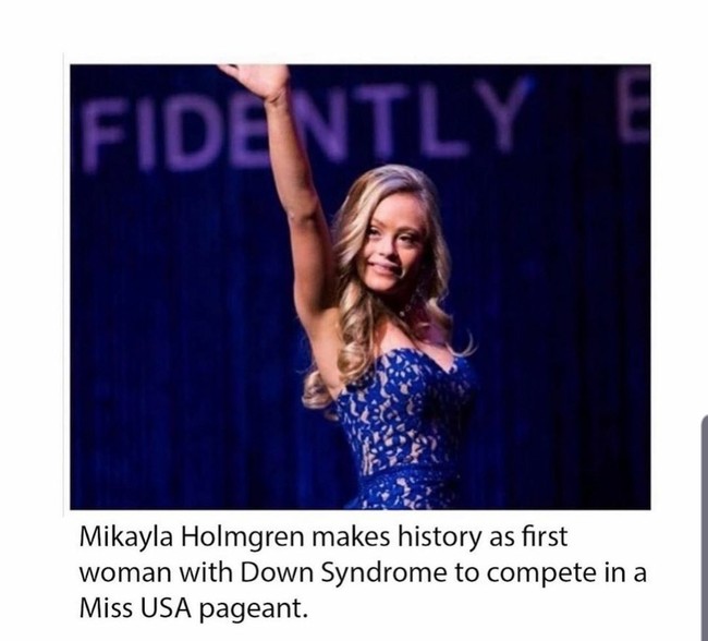 Aku seorang penari, model, pembicara publik, dan lulusan perguruan tinggi. Aku wanita pertama down syndrome yang berkompetisi di kontes Miss USA. Aku berhasil tampil dengan pakaian renang di atas panggung (Miss USA). Sekarang saatnya mengguncang majalah, ungkap Mikayla. Foto: Instagram