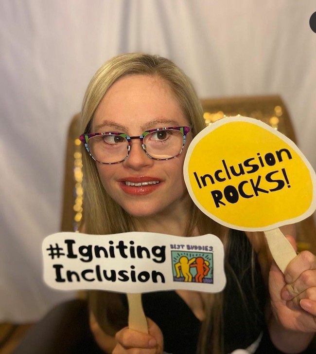 Memiliki down syndrome, aku ingin menunjukkan kepada yang lain bahwa bisa lebih diterima. Sports Illustrated Swim telah menjadi juara dalam keanekaragaman kecantikan. Sekarang saatnya memasukkan seseorang sepertiku, ungkap Mikayla, seperti dikutip dari Daily Mail. Foto: Instagram