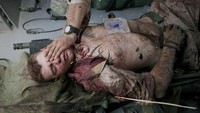 Dilansir dari Associated Press, konflik dua dekade tersebut berhasil direkam dari setiap sudut.  