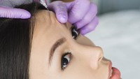 Suntik Botox VS Filler, Mending Mana untuk Atasi Kerutan di Wajah?