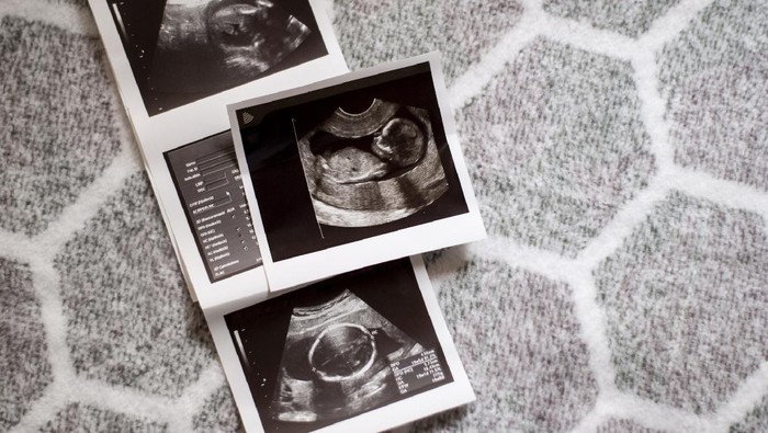 1297503286 Ultrasound results in the second trimester of pregnancy. Photo of the fetus on a light geometric background. Expectation of the child. Infertility treatment. Artificial insemination. Having a baby with IVF.