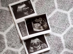 Lewat Bayi Tabung, Pasutri Bisa Pilih Jenis Kelamin Calon Bayi