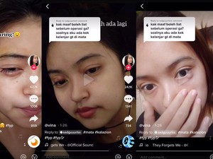 Viral Kista di Mata Disangka Bintitan, Tak Tahunya Kalazion dan Harus Operasi