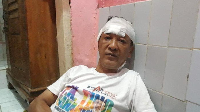 Kisah Sopir Gagalkan Perampokan di Rumah Majikan, Tertembak 5 Kali, Selasa (20/4/2021).