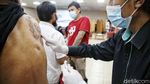 Layanan Hapus Tato Gratis di Bulan Suci Ramadhan