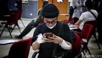 Nantinya setelah selesai di laser, bekas luka tato harus di kasih salep luka bakar guna mengurangi rasa perih.