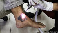 Dan luka bekas tato itu tidak boleh terkena air dulu sampai pulih.