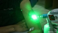 Cara yang dilakukan adalah dengan memberikan laser terhadap tato tersebut.