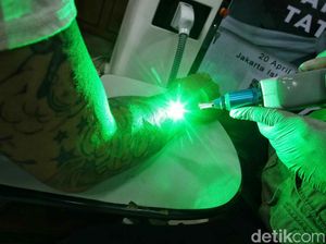 Layanan Hapus Tato Gratis di Bulan Suci Ramadhan